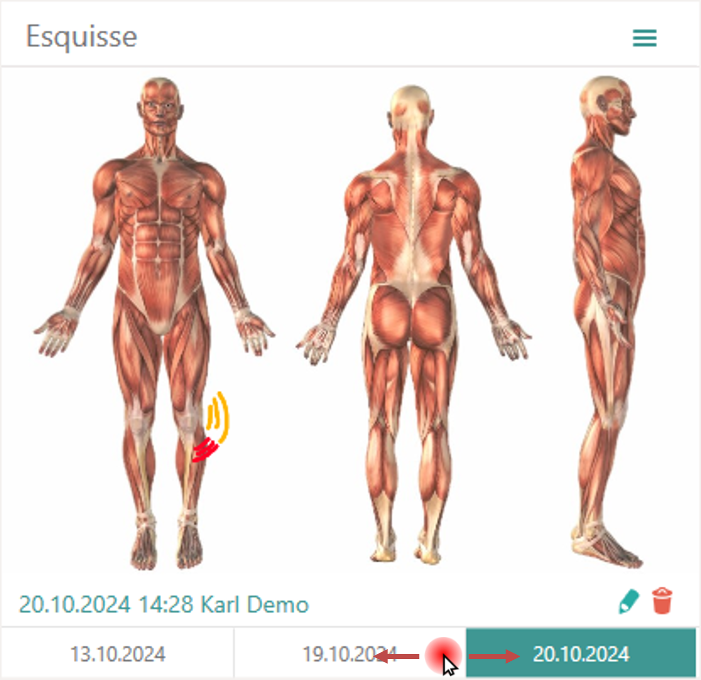 Assessment visuel