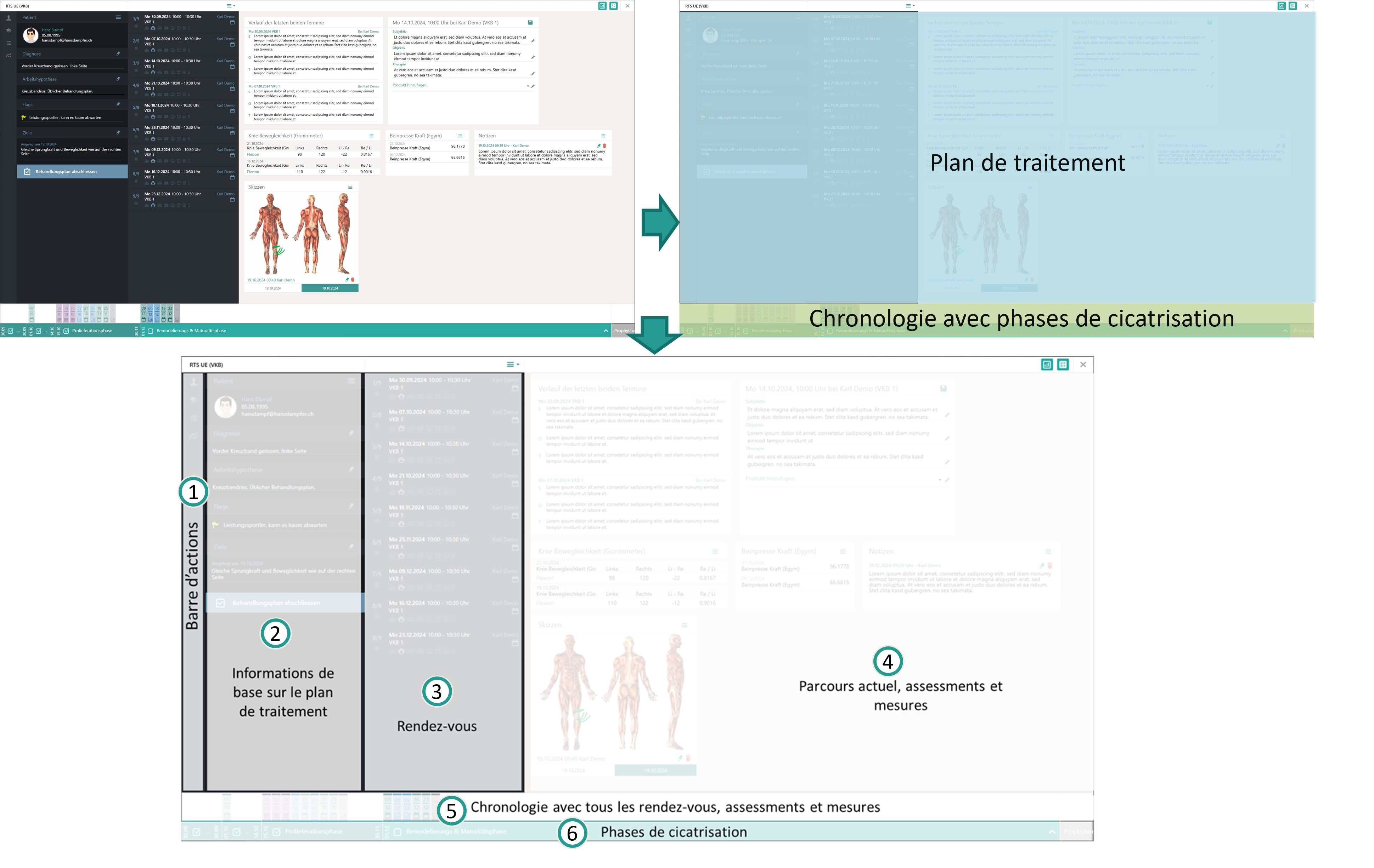 Dialogue du plan de traitement