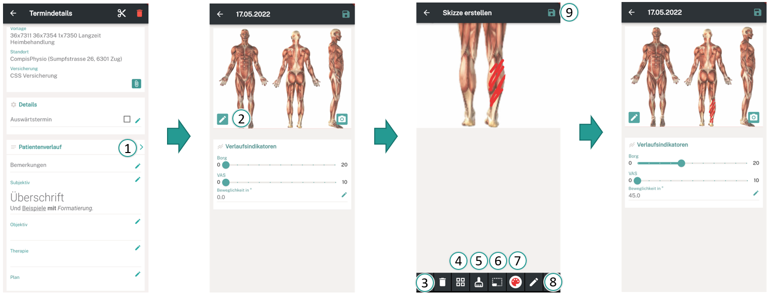 Patientenverlauf visuell